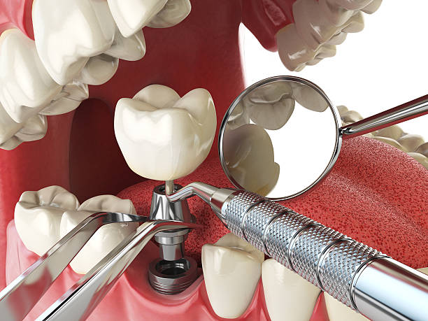 Best Orthodontic Emergency Dentist in Beulah, ND